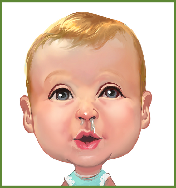 Step 1. Baby with sinus